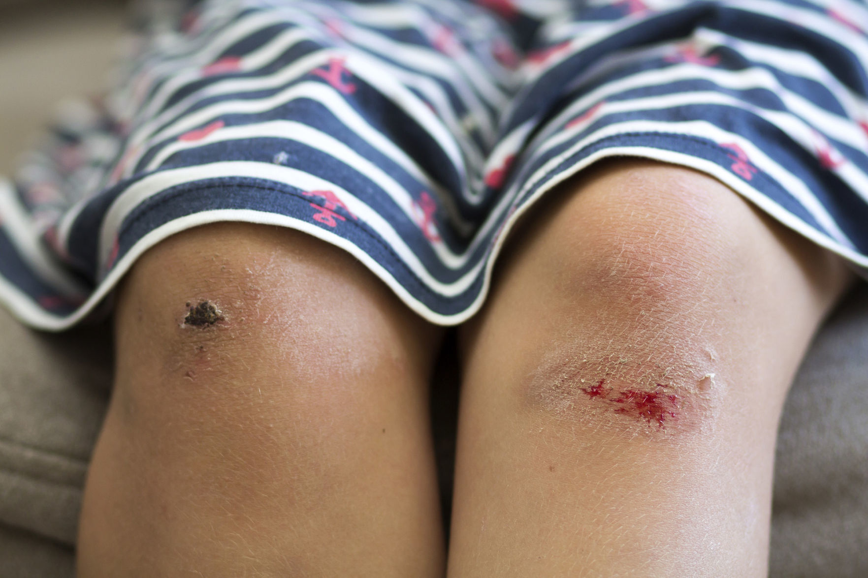 Unexplained injuries